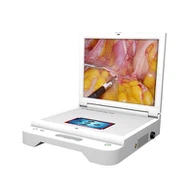 Nešiojama HD ekrano Ent endoskopinė kamera